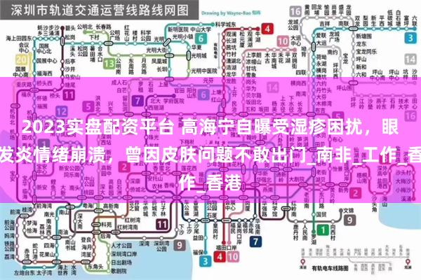 2023实盘配资平台 高海宁自曝受湿疹困扰，眼部发炎情绪崩溃，曾因皮肤问题不敢出门_南非_工作_香港